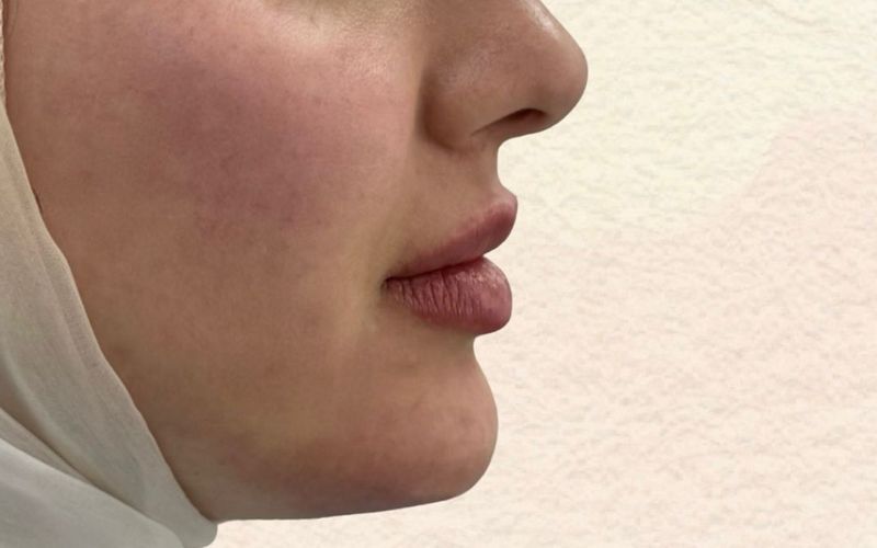 Après — Soin Visage