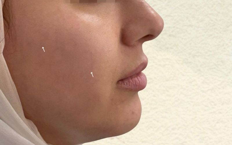 Avant — Soin Visage